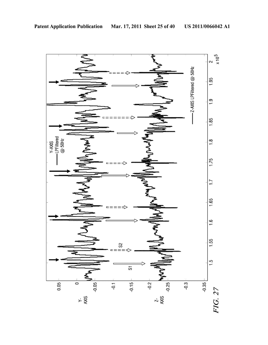 ESTIMATION OF BLOOD FLOW AND HEMODYNAMIC PARAMETERS FROM A SINGLE CHEST-WORN SENSOR, AND OTHER CIRCUITS, DEVICES AND PROCESSES - diagram, schematic, and image 26