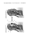 SYSTEM FOR MEASURING VITAL SIGNS DURING HEMODIALYSIS diagram and image