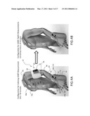 BODY-WORN VITAL SIGN MONITOR diagram and image