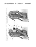 BODY-WORN VITAL SIGN MONITOR diagram and image