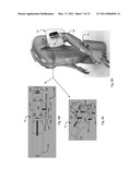 BODY-WORN VITAL SIGN MONITOR diagram and image