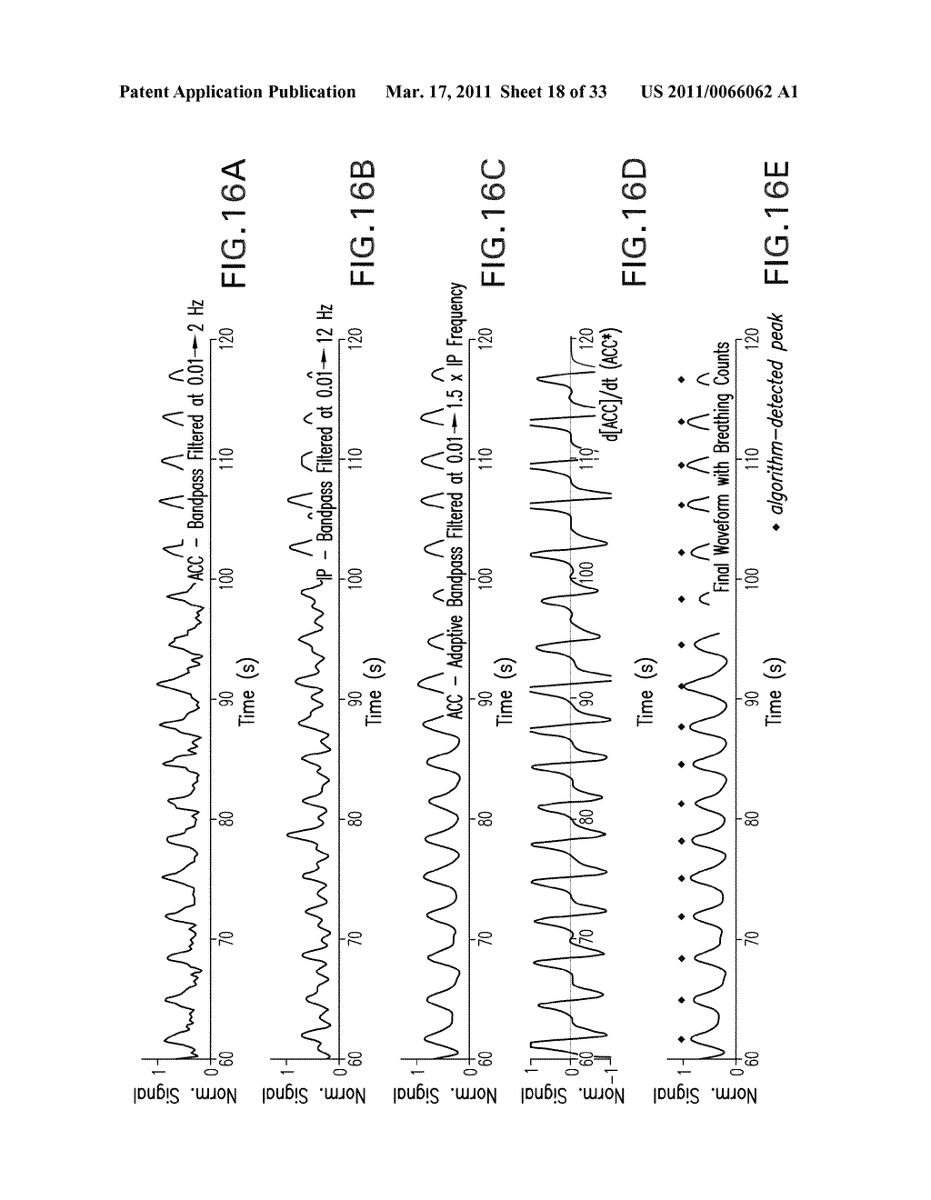 BODY-WORN MONITOR FOR MEASURING RESPIRATION RATE - diagram, schematic, and image 19