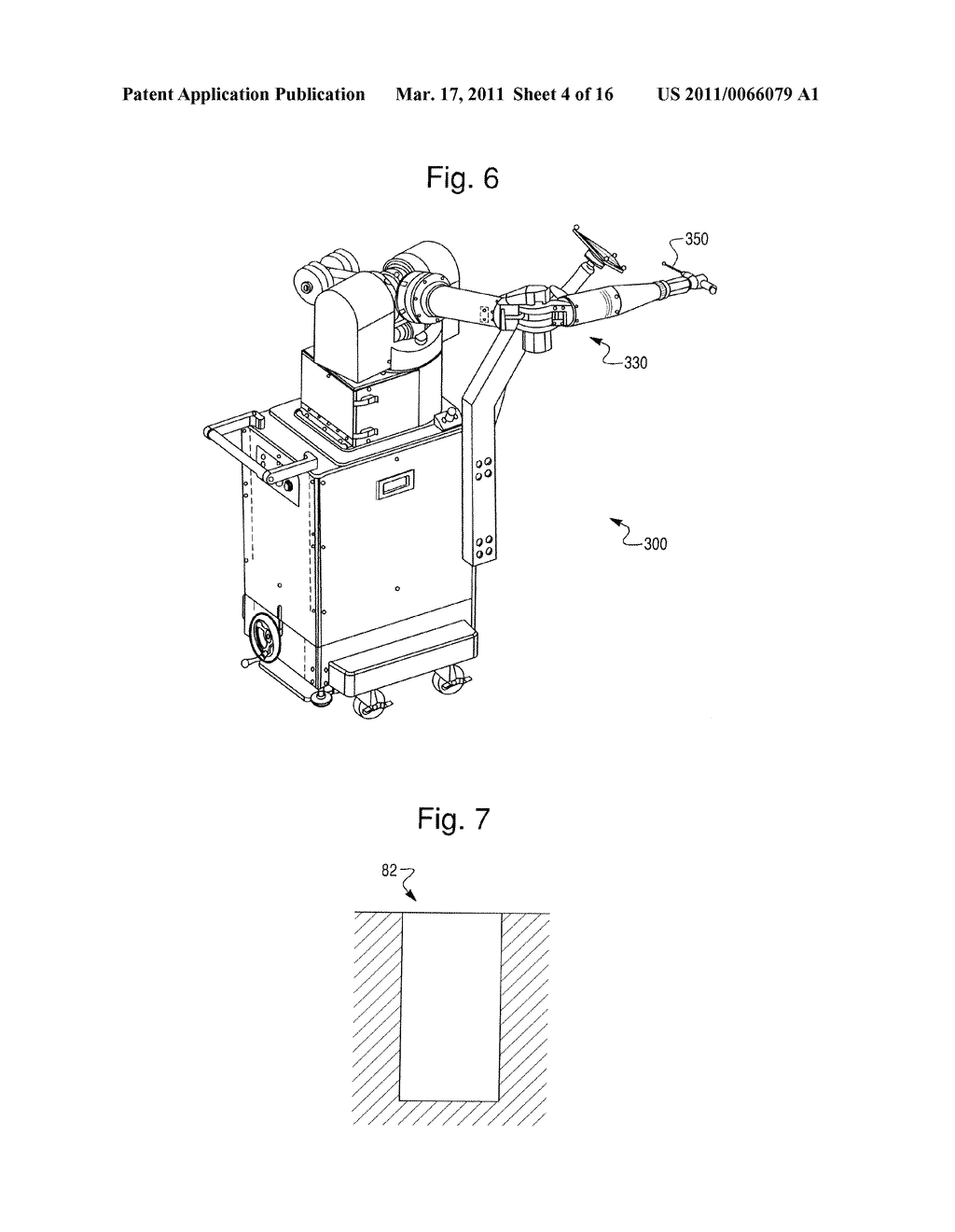 PROSTHETIC DEVICE AND SYSTEM AND METHOD FOR IMPLANTING PROSTHETIC DEVICE - diagram, schematic, and image 05