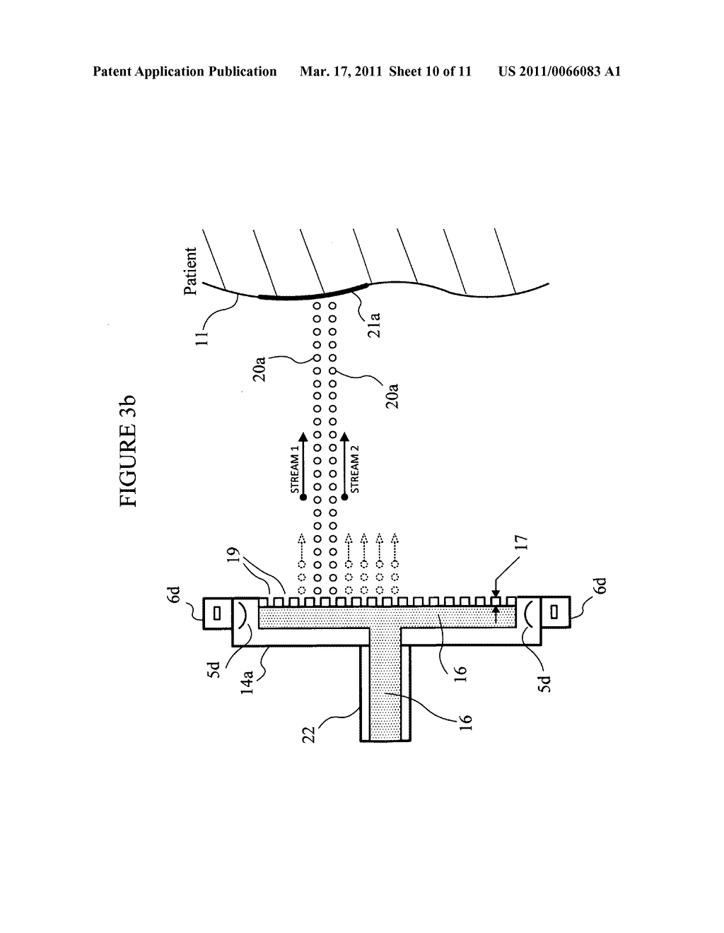 Ultrasonic apparatus and method for treating obesity or fat-deposits or for delivering cosmetic or other bodily therapy - diagram, schematic, and image 11