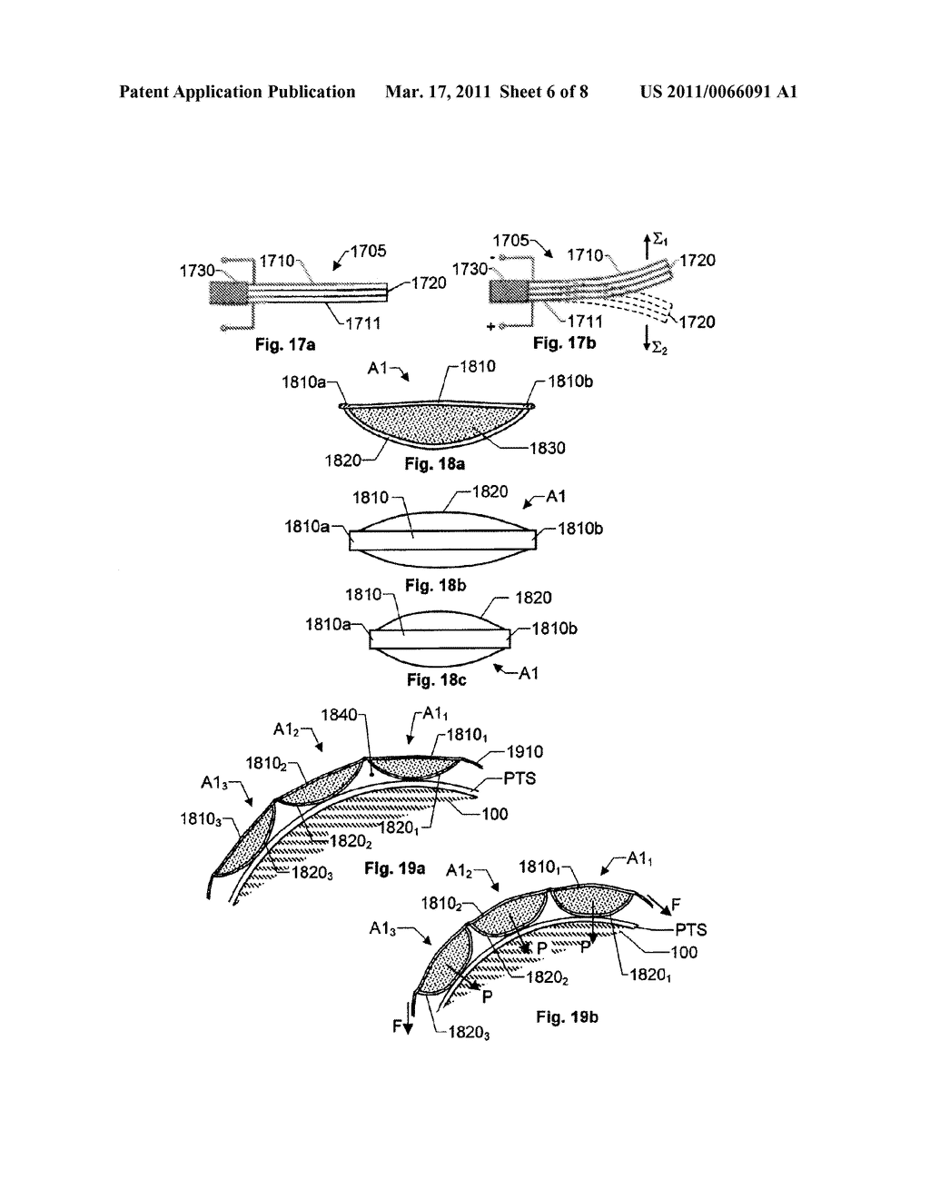 ELECTRO ACTIVE COMPRESSION BANDAGE - diagram, schematic, and image 07