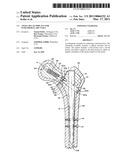 ANGULAR LAG IMPLANT FOR INTRAMEDULLARY NAILS diagram and image