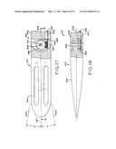 ANGULAR LAG IMPLANT FOR INTRAMEDULLARY NAILS diagram and image