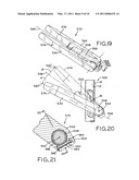 ANGULAR LAG IMPLANT FOR INTRAMEDULLARY NAILS diagram and image