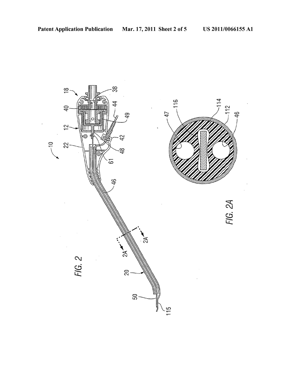 Surgical file - diagram, schematic, and image 03