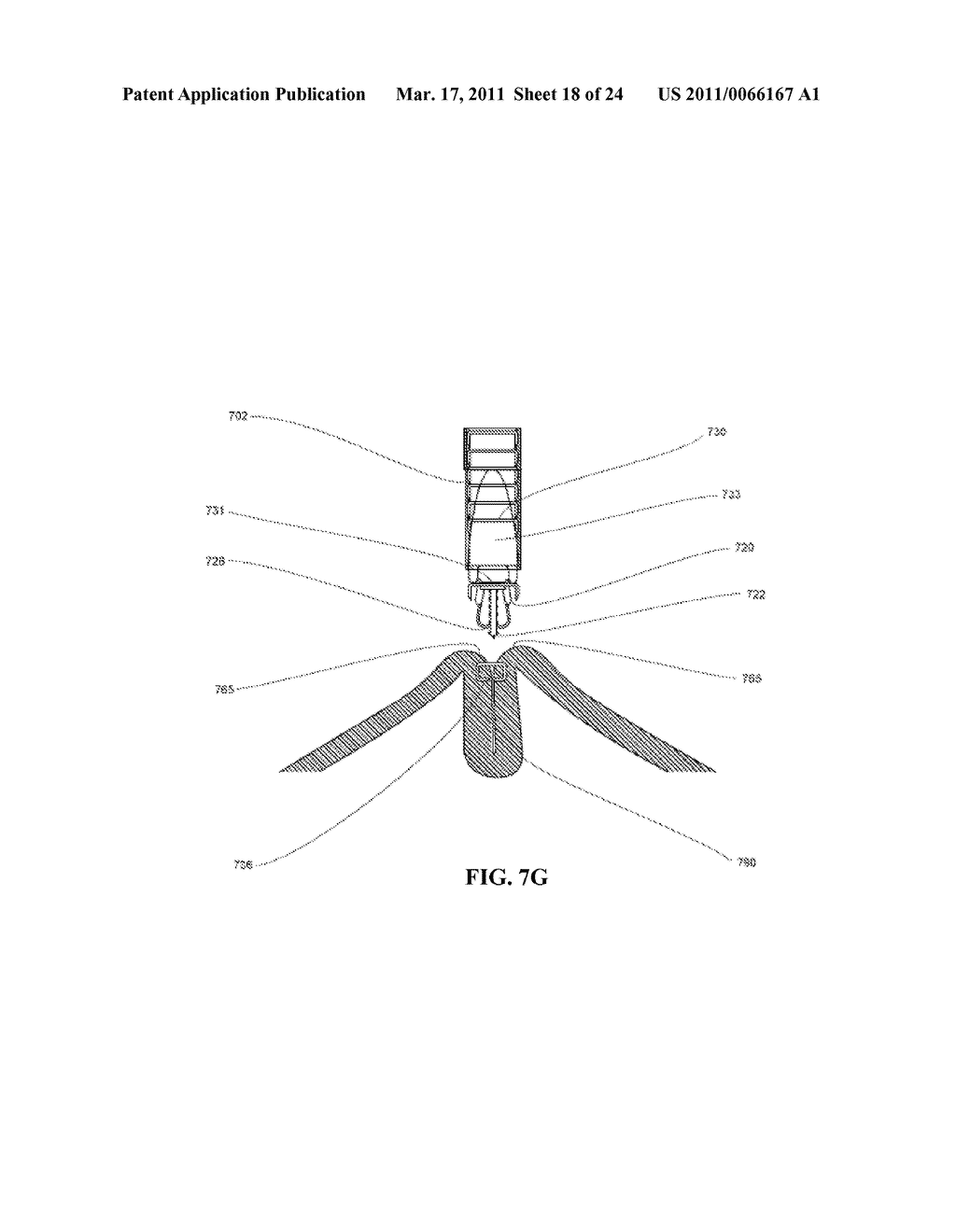 DEVICES AND SYSTEMS FOR MANIPULATING TISSUE - diagram, schematic, and image 19