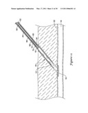 TISSUE PUNCTURE CLOSURE DEVICE diagram and image