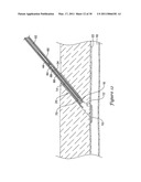 TISSUE PUNCTURE CLOSURE DEVICE diagram and image