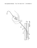 TISSUE PUNCTURE CLOSURE DEVICE diagram and image