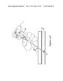 TISSUE PUNCTURE CLOSURE DEVICE diagram and image