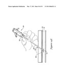 TISSUE PUNCTURE CLOSURE DEVICE diagram and image