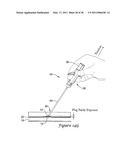 TISSUE PUNCTURE CLOSURE DEVICE diagram and image