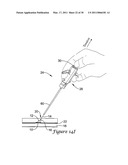 TISSUE PUNCTURE CLOSURE DEVICE diagram and image