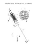 TISSUE PUNCTURE CLOSURE DEVICE diagram and image