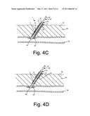 APPARATUS AND METHODS FOR SEALING A VASCULAR PUNCTURE diagram and image