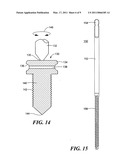 Bone joint suture button and grommet and kit using same diagram and image