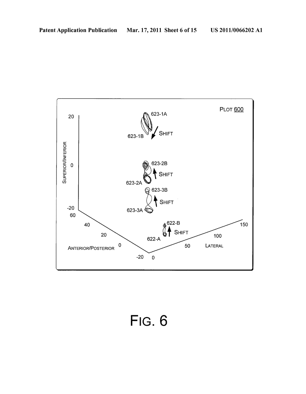 ELECTRODE AND LEAD STABILITY INDEXES AND STABILITY MAPS BASED ON LOCALIZATION SYSTEM DATA - diagram, schematic, and image 07