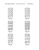 HYBRID INTRALUMINAL DEVICE diagram and image