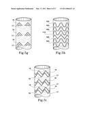 HYBRID INTRALUMINAL DEVICE diagram and image