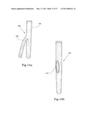 HYBRID INTRALUMINAL DEVICE diagram and image