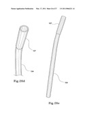 HYBRID INTRALUMINAL DEVICE diagram and image