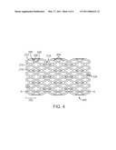 Bioabsorbable Stent With Time Dependent Structure And Properties diagram and image