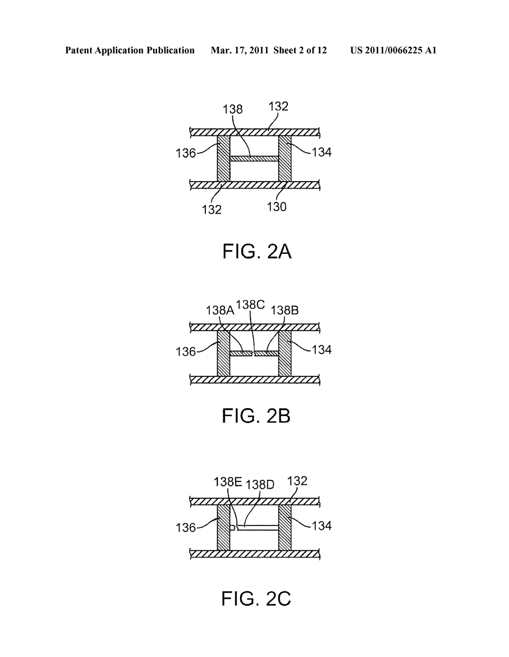 Bioabsorbable Stent With Time Dependent Structure And Properties And Regio-Selective Degradation - diagram, schematic, and image 03