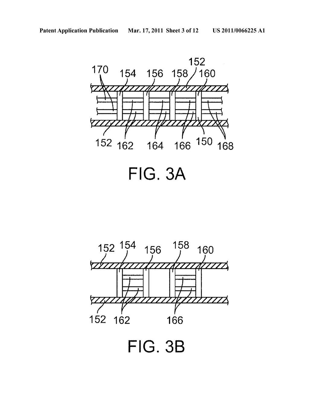 Bioabsorbable Stent With Time Dependent Structure And Properties And Regio-Selective Degradation - diagram, schematic, and image 04