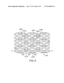 Bioabsorbable Stent With Time Dependent Structure And Properties And Regio-Selective Degradation diagram and image