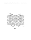 Bioabsorbable Stent With Time Dependent Structure And Properties And Regio-Selective Degradation diagram and image