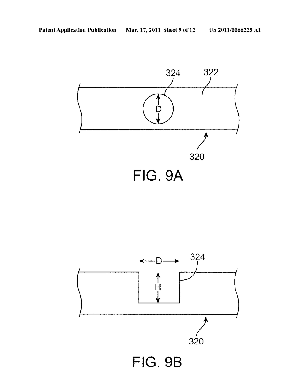 Bioabsorbable Stent With Time Dependent Structure And Properties And Regio-Selective Degradation - diagram, schematic, and image 10