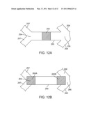 Bioabsorbable Stent With Time Dependent Structure And Properties And Regio-Selective Degradation diagram and image