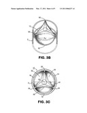 PROSTHETIC TISSUE VALVE diagram and image