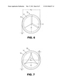 PROSTHETIC TISSUE VALVE diagram and image