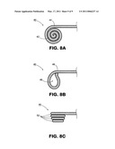 PROSTHETIC TISSUE VALVE diagram and image