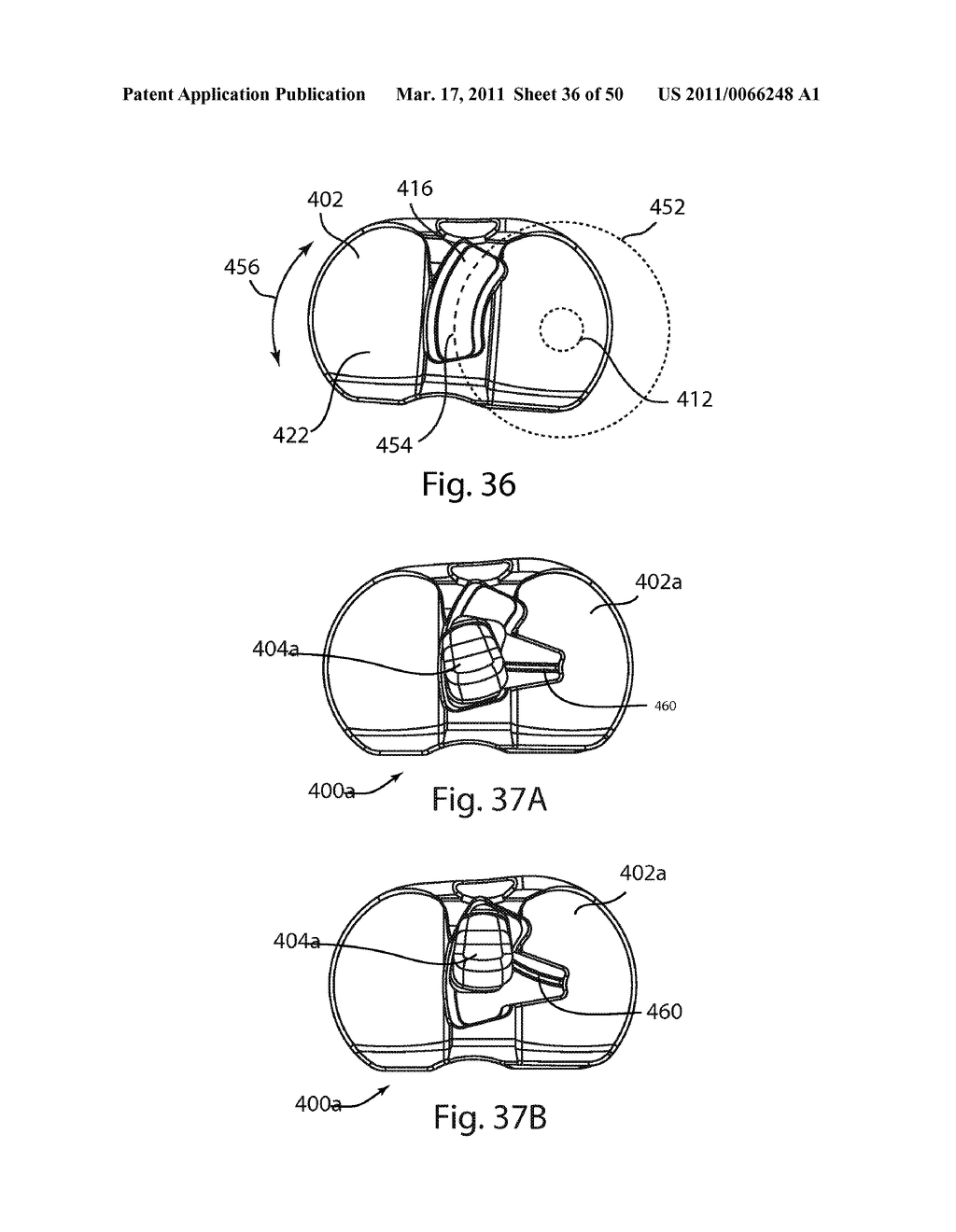 Position Adjustable Trial Systems for Prosthetic Implants - diagram, schematic, and image 37