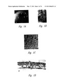 ANTI-ANGIOGENIC COMPOSITIONS AND METHODS OF USE diagram and image