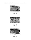 ANTI-ANGIOGENIC COMPOSITIONS AND METHODS OF USE diagram and image