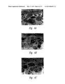 ANTI-ANGIOGENIC COMPOSITIONS AND METHODS OF USE diagram and image