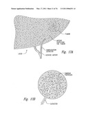 ANTI-ANGIOGENIC COMPOSITIONS AND METHODS OF USE diagram and image