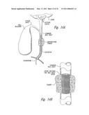 ANTI-ANGIOGENIC COMPOSITIONS AND METHODS OF USE diagram and image