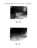 ANTI-ANGIOGENIC COMPOSITIONS AND METHODS OF USE diagram and image