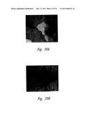 ANTI-ANGIOGENIC COMPOSITIONS AND METHODS OF USE diagram and image