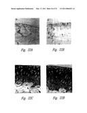 ANTI-ANGIOGENIC COMPOSITIONS AND METHODS OF USE diagram and image