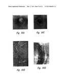 ANTI-ANGIOGENIC COMPOSITIONS AND METHODS OF USE diagram and image