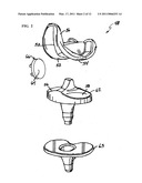 CERAMIC COATED ORTHOPAEDIC IMPLANTS AND METHOD OF MAKING SUCH IMPLANTS diagram and image